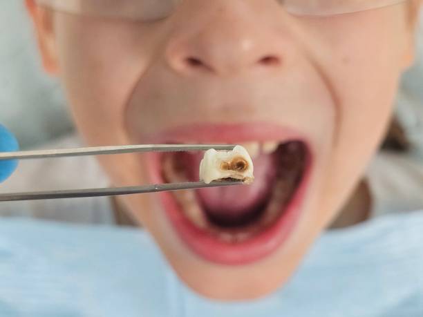 Best Pediatric Emergency Dentist in , MN